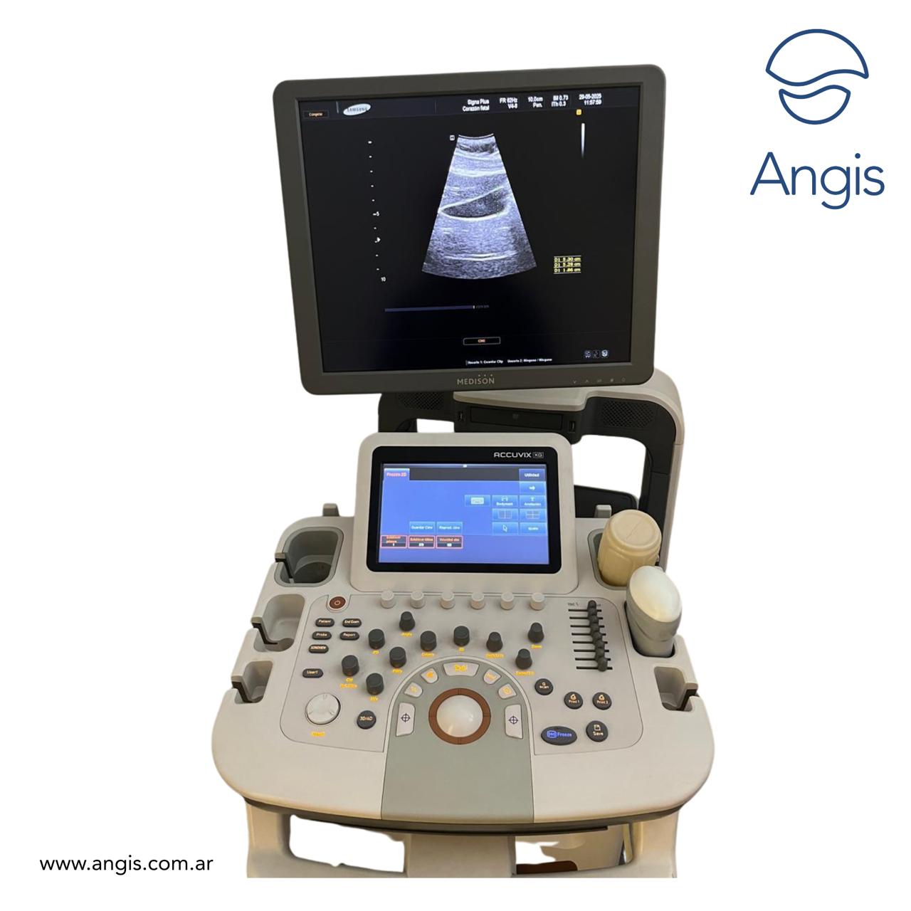 Ecógrafo Samsung Medison ACCUVIX XG